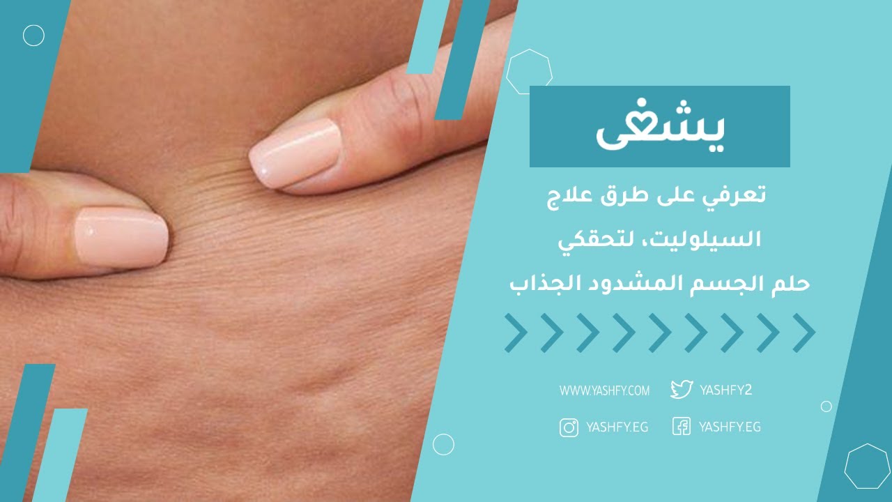 تعرفي على طرق علاج السيلوليت، لتحقكي حلم الجسم المشدود الجذاب