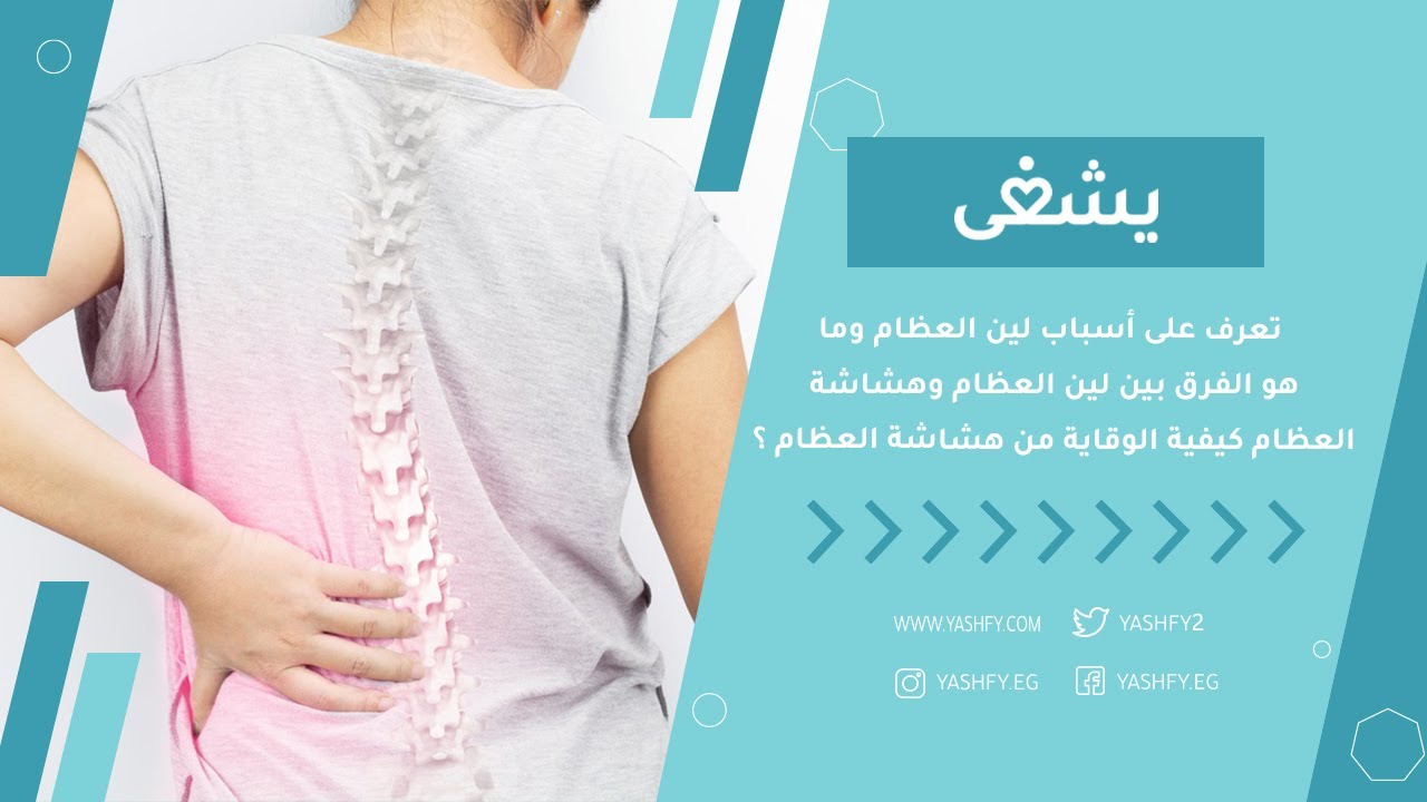 تعرف على أسباب لين العظام وما هو الفرق بين لين العظام وهشاشة العظام كيفية الوقاية من هشاشة العظام ؟