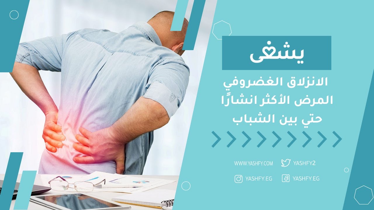 الانزلاق الغضروفي المرض الأكثر انشارًا حتي بين الشباب