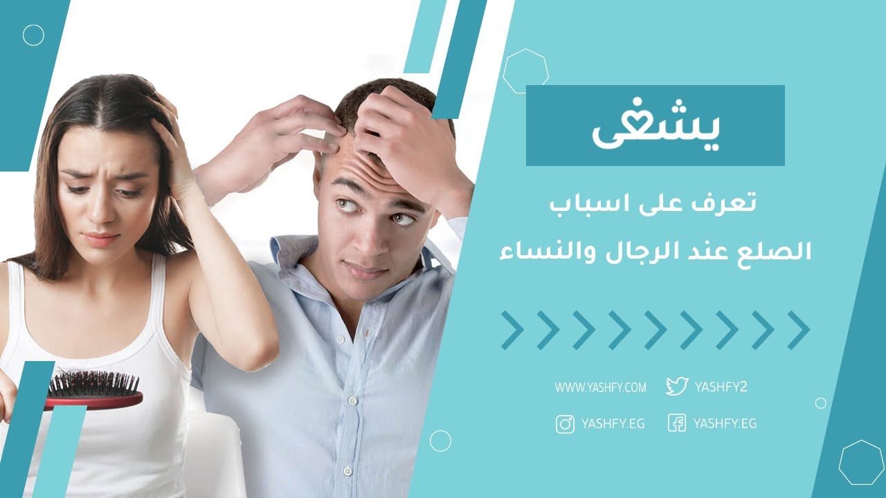 تعرف على اسباب الصلع عند الرجال والنساء