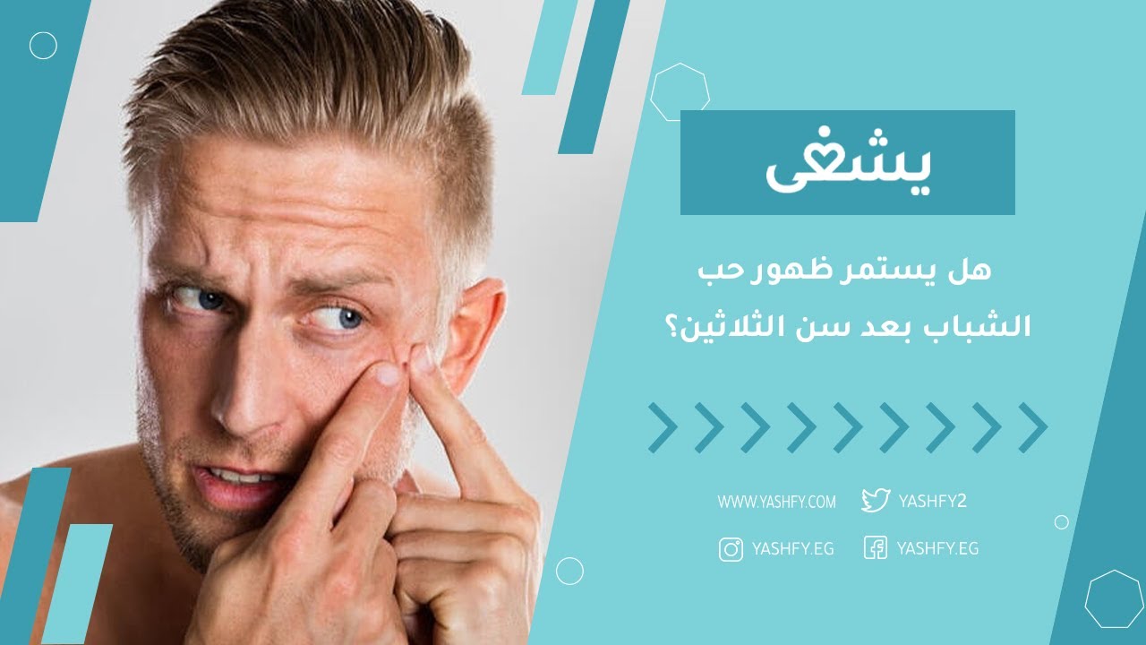 هل يستمر ظهور حب الشباب بعد سن الثلاثين؟