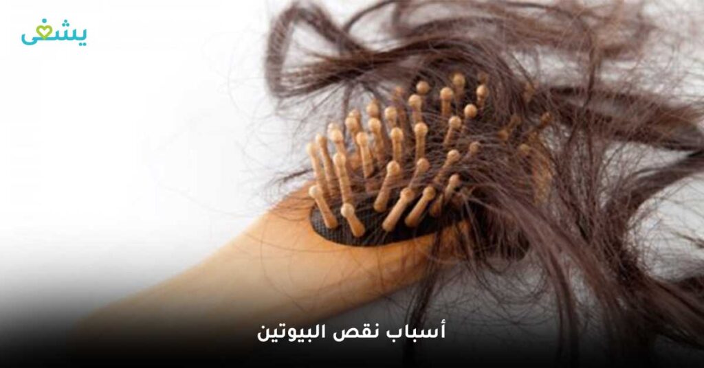 أسباب-نقص-البيوتين