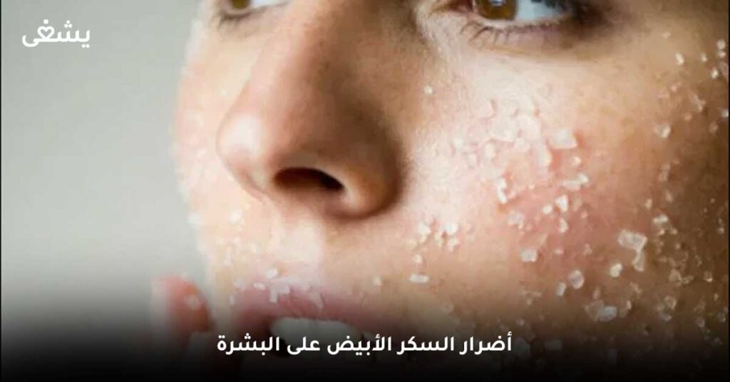 أضرار-السكر-الأبيض-على-البشرة