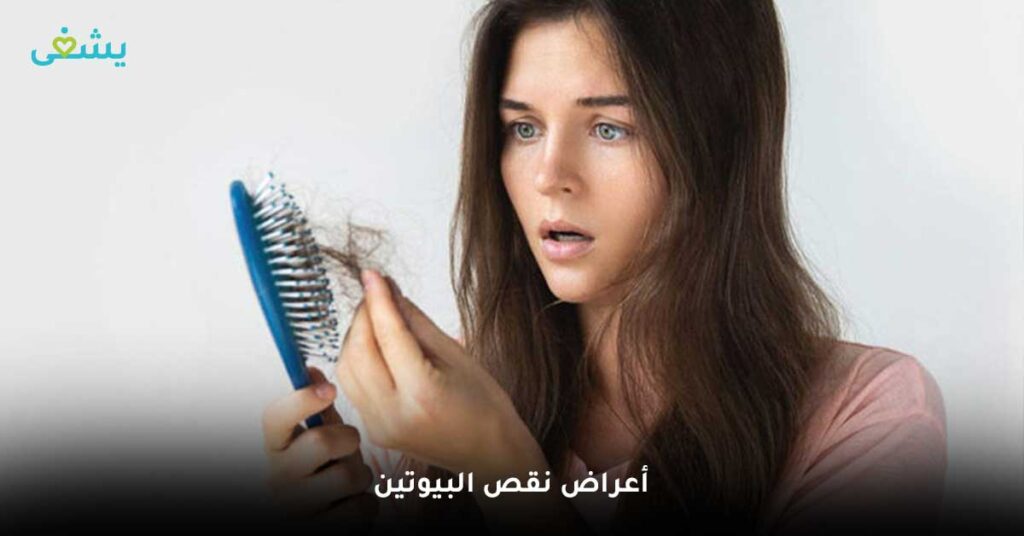 أعراض-نقص-البيوتين