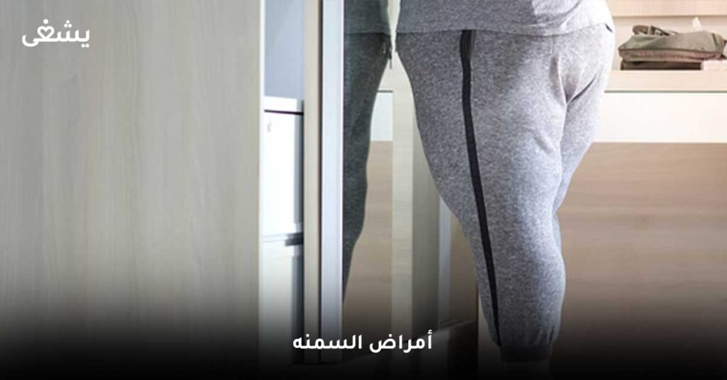 أمراض-السمنه