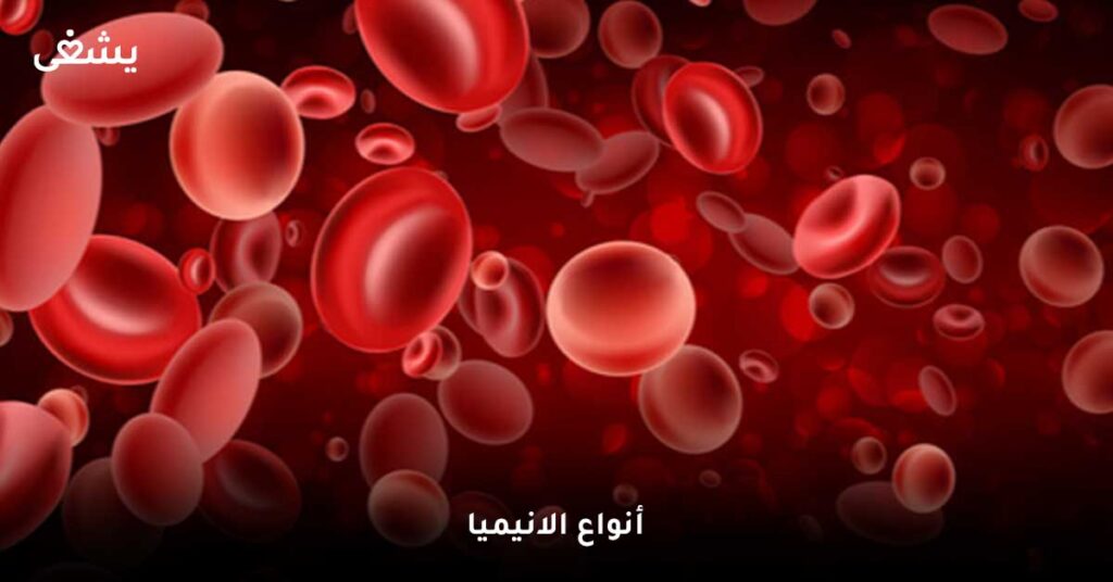 أنواع-الانيميا