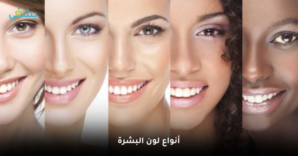 أنواع-لون-البشرة