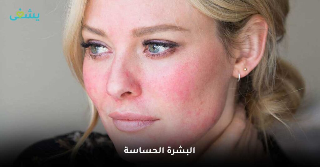 البشرة-الحساسة