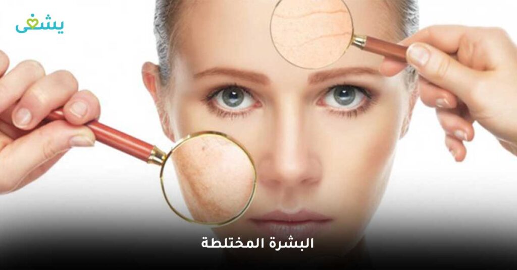 البشرة-المختلطة