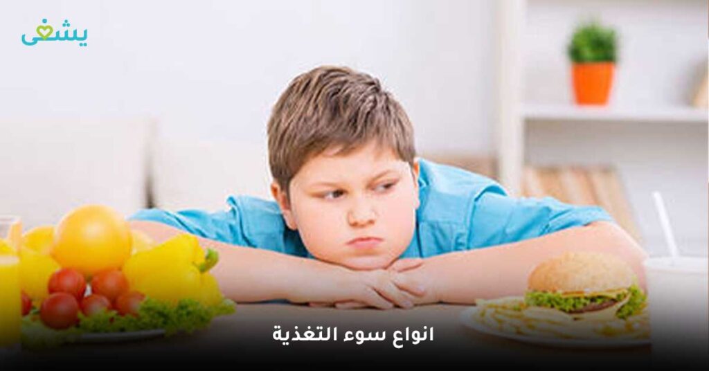 انواع-سوء-التغذية