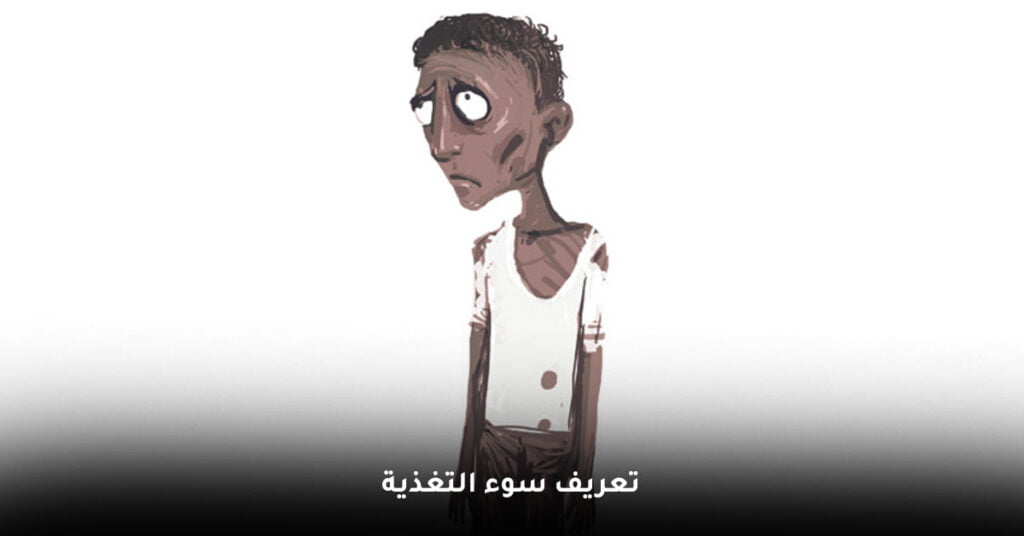 علاج سوء التغذية