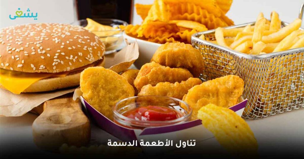 تناول-الأطعمة-الدسمة
