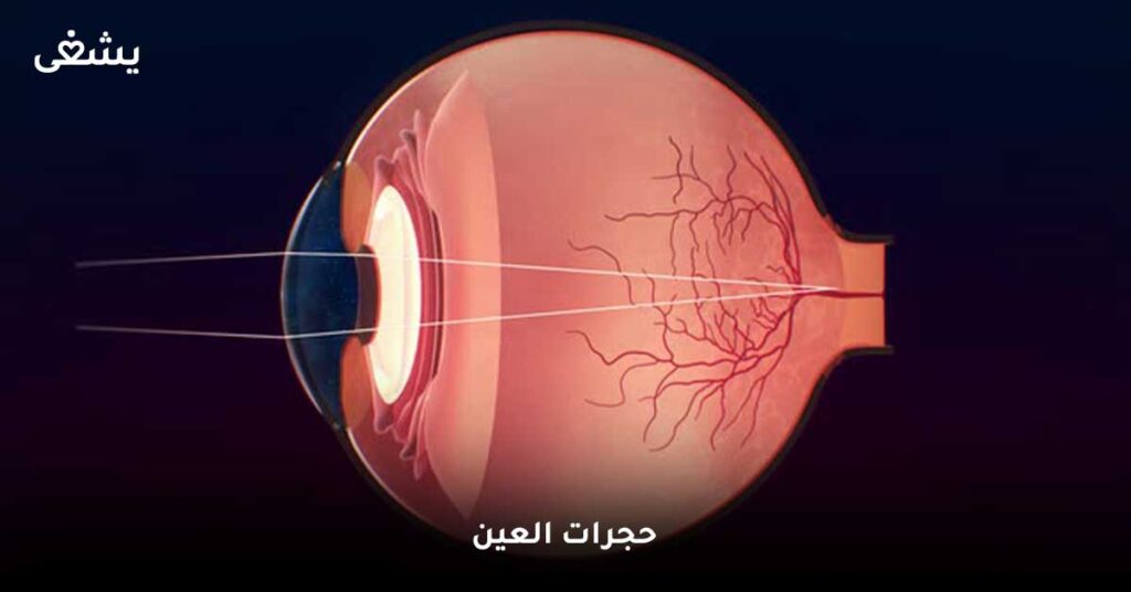 حجرات-العين