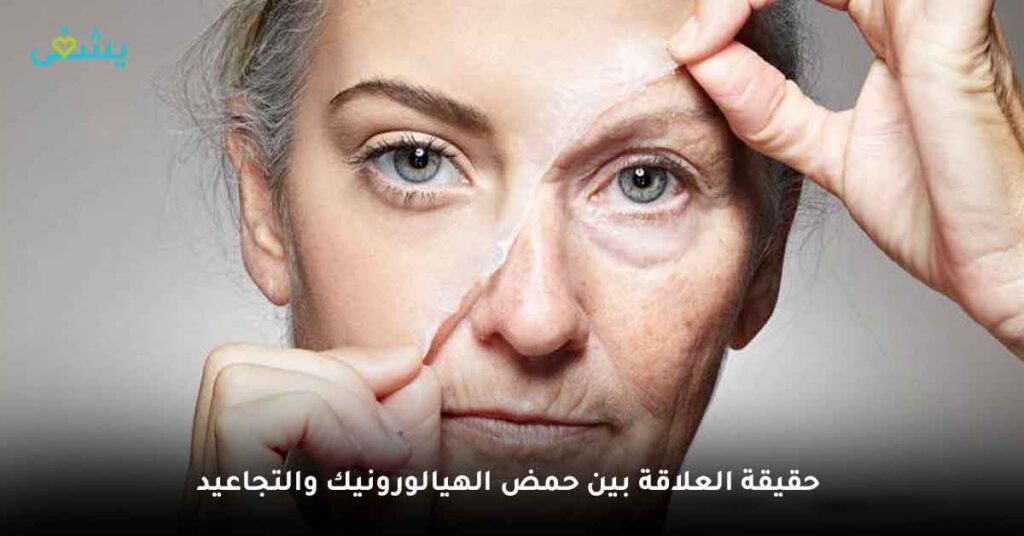 حقيقة العلاقة بين حمض الهيالورونيك والتجاعيد