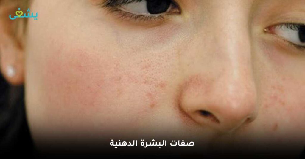 صفات-البشرة-الدهنية