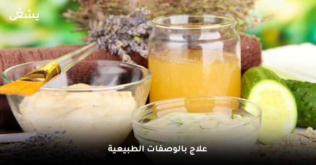 علاج-بالوصفات-الطبيعية