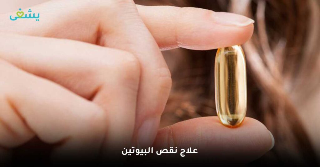 علاج-نقص-البيوتين