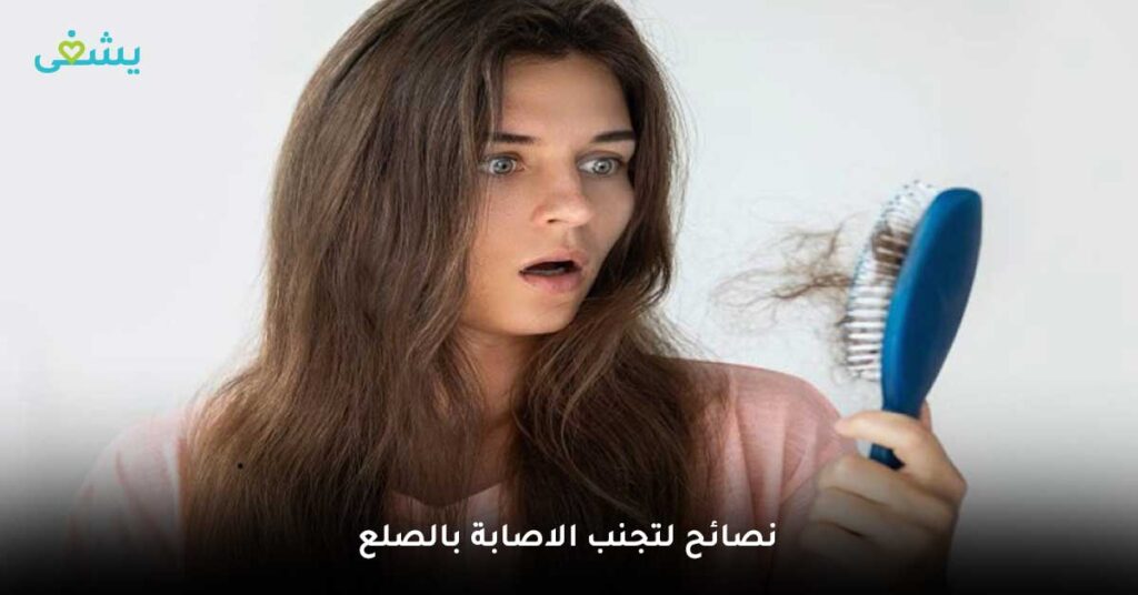 نصائح-لتجنب-الاصابة-بالصلع