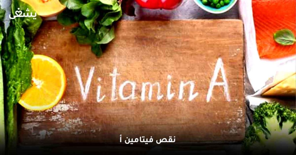 نقص-فيتامين-أ
