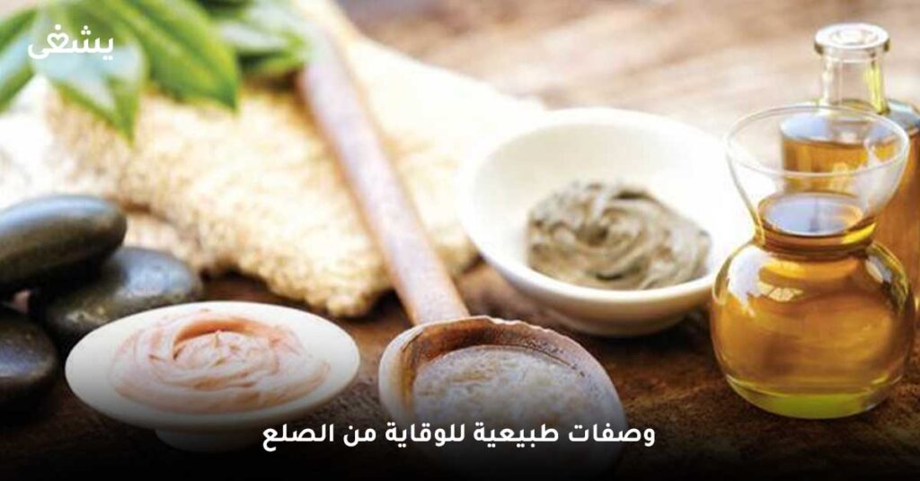 وصفات-طبيعية-للوقاية-من-الصلع