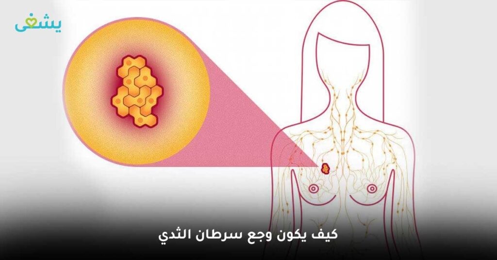 كيف-يكون-وجع-سرطان-الثدي