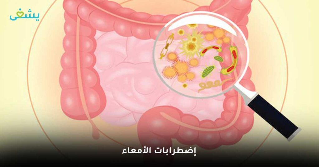 إضطرابات-الأمعاء