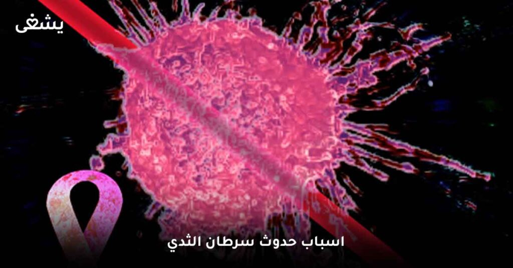 اسباب-حدوث-سرطان-الثدي