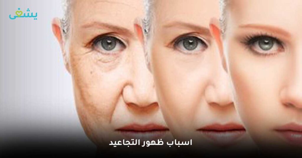 اسباب-ظهور-التجاعيد