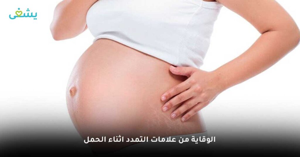 الوقاية-من-علامات-التمدد-اثناء-الحمل