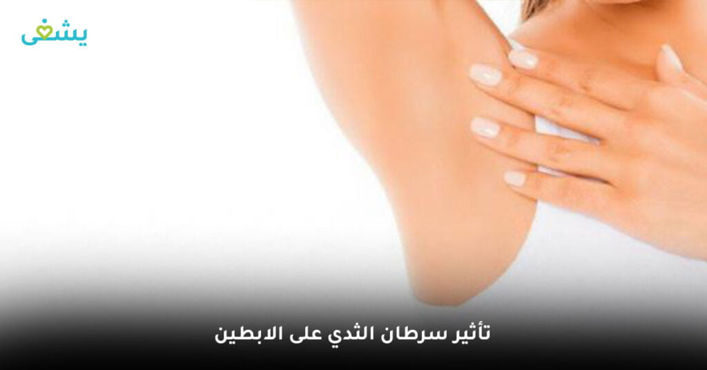 تأثير-سرطان-الثدي-على-الابطين