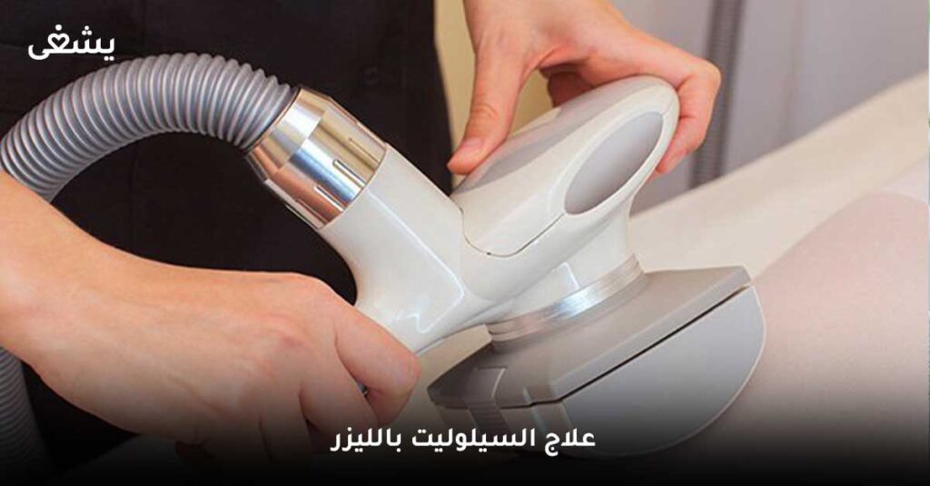 علاج-السيلوليت-بالليزر