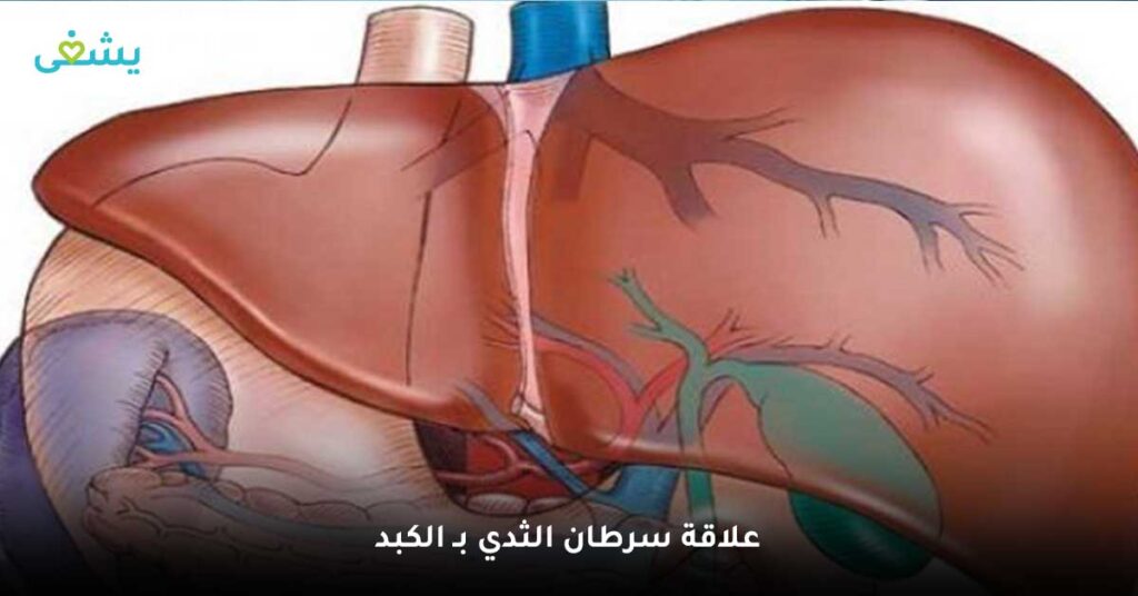 علاقة-سرطان-الثدي-بـ-الكبد