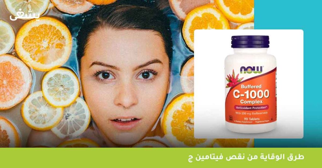 طرق-الوقاية-من-نقص-فيتامين-ج