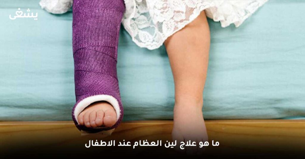 ما هو علاج لين العظام عند الاطفال