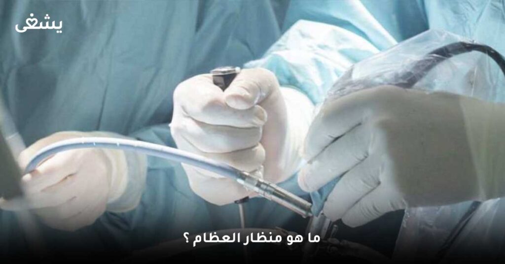 ما-هو-منظار-العظام-؟