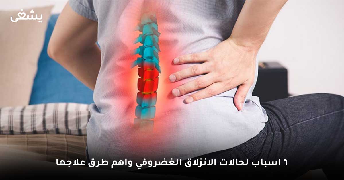 اسباب الانزلاق الغضروفي \ علاج الانزلاق الغضروفي \ اعراض الانزلاق القطني