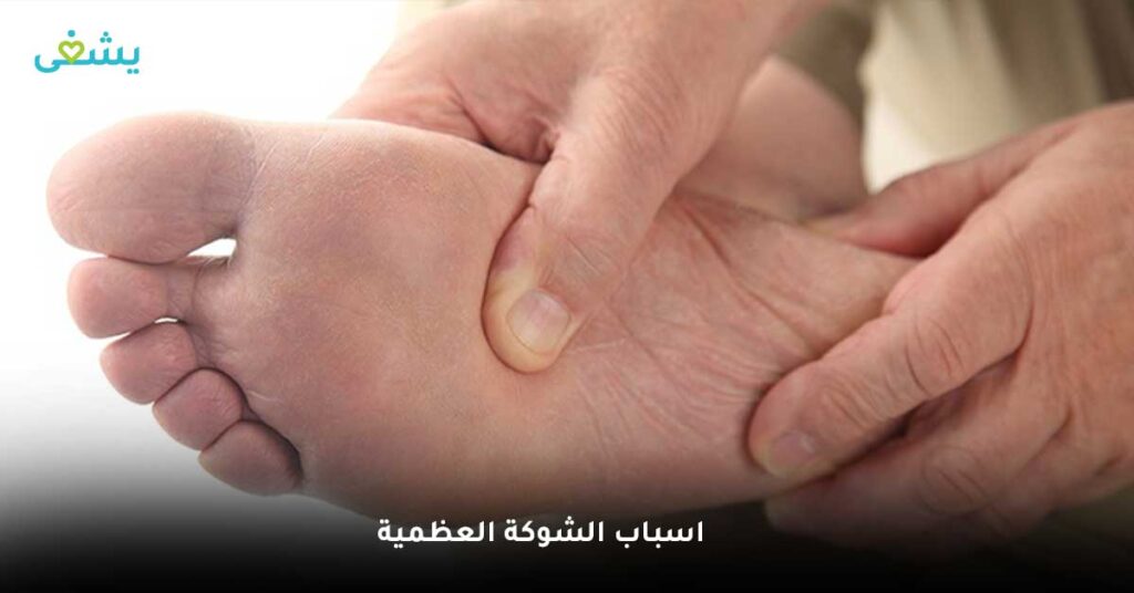 اسباب الشوكة العظمية