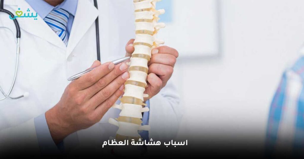 اسباب هشاشة العظام