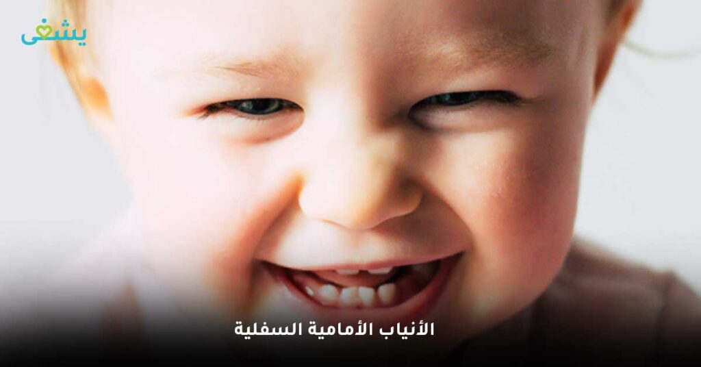 الأنياب الأمامية السفلية