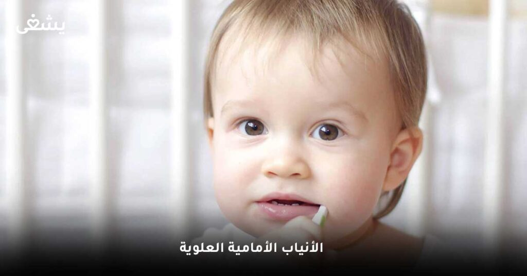 الأنياب الأمامية العلوية