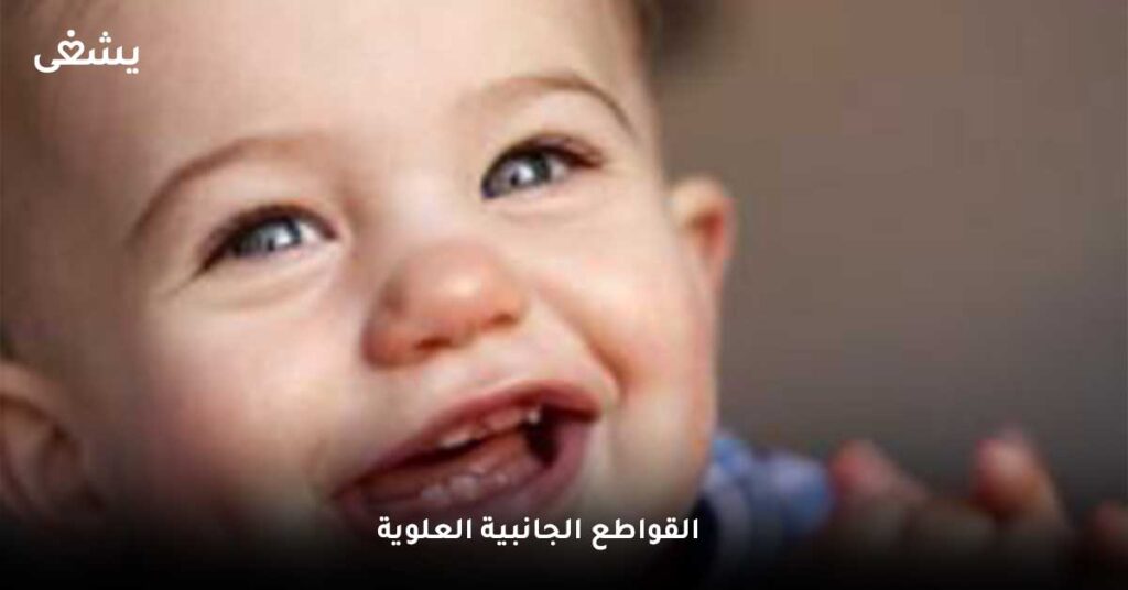 القواطع الجانبية العلوية