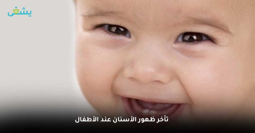 تأخر ظهور الأسنان عند الأطفال