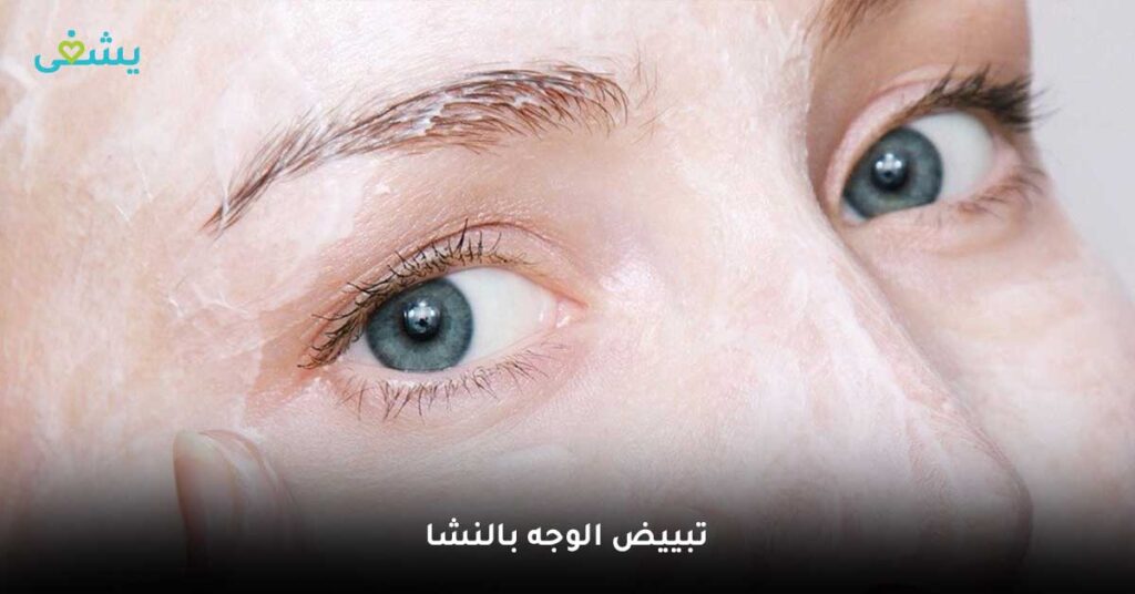 تبييض الوجه بالنشا