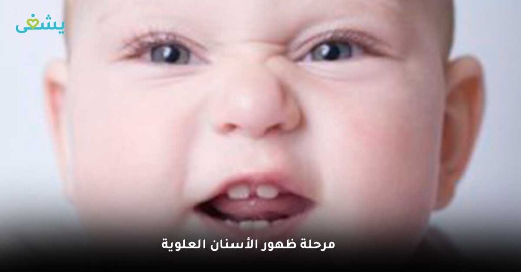 مرحلة ظهور الأسنان العلوية