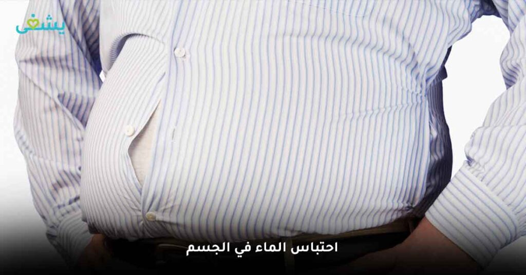 احتباس الماء في الجسم