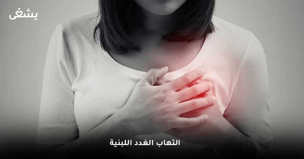 التهاب الغدد اللبنية