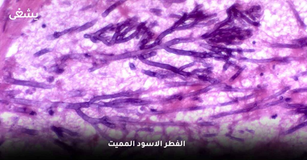 الفطر الاسود المميت