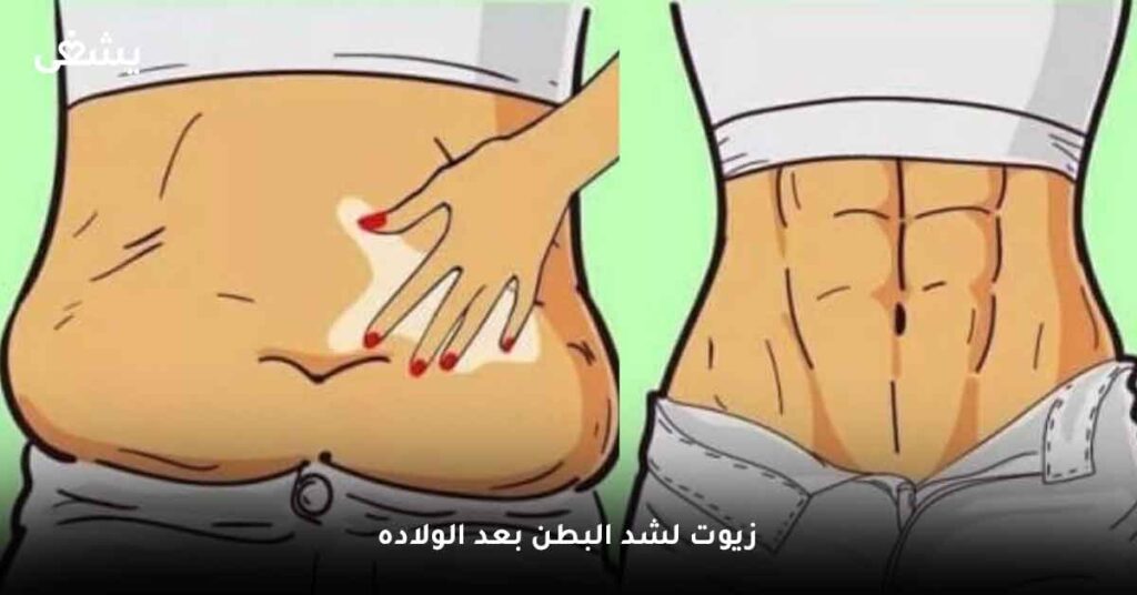 زيوت لشد البطن بعد الولاده