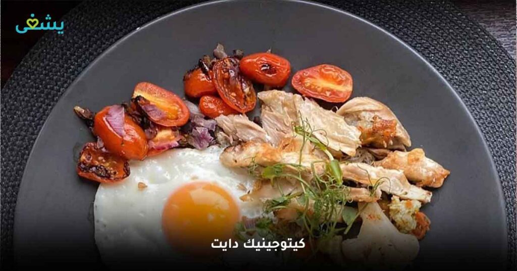 كيتوجينيك دايت