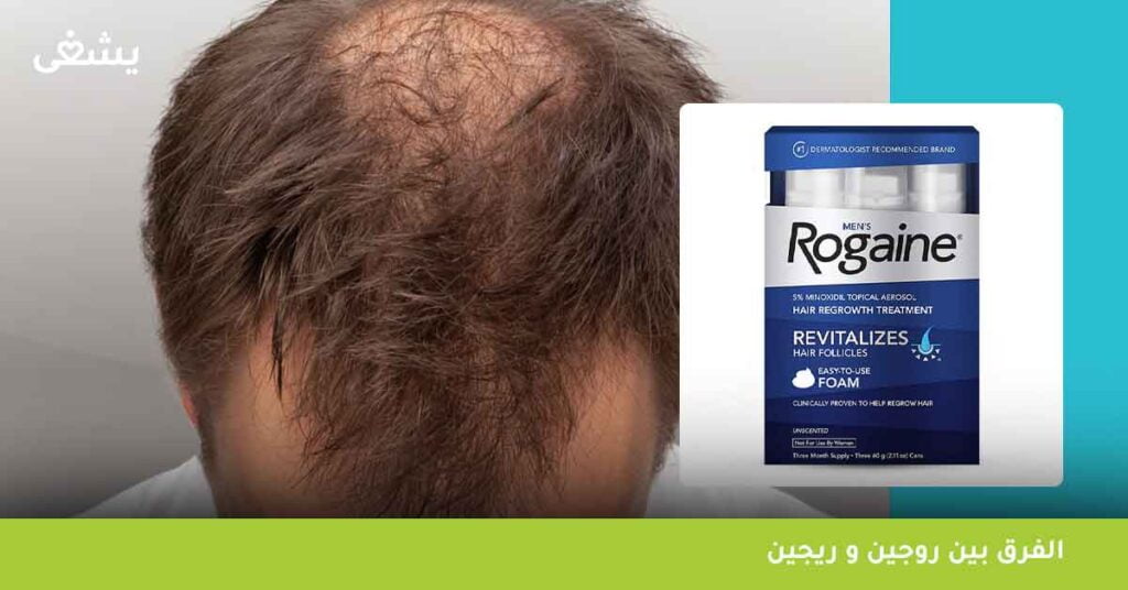 ما هو الفرق بين روجين و ريجين ؟